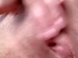 Nicole Charming Masturbates her Post Op Pussy