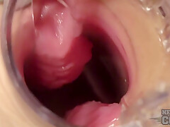Sexy Nurse Riki Gyno Speculum Play Gaping Ginger Pussy With Closeups Of Pussy Walls