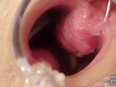 Sexy Nurse Riki Gyno Speculum Play Gaping Ginger Pussy With Closeups Of Pussy Walls
