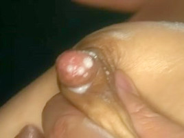 Teat Stretching Lactation